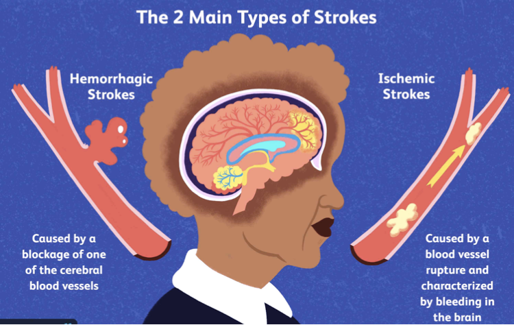 Types Of Brain Injuries - Health Bound Health Network